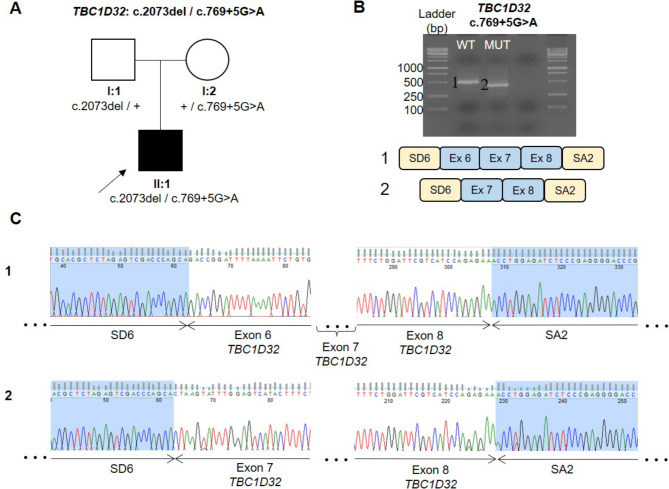 Two novel mutations in TBC1D32 add complexity to the oro-facial-digital syndrome.
