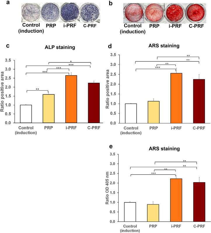 A comparative study of three liquid platelet concentrates on human primary osteoblast activity: an in vitro study.