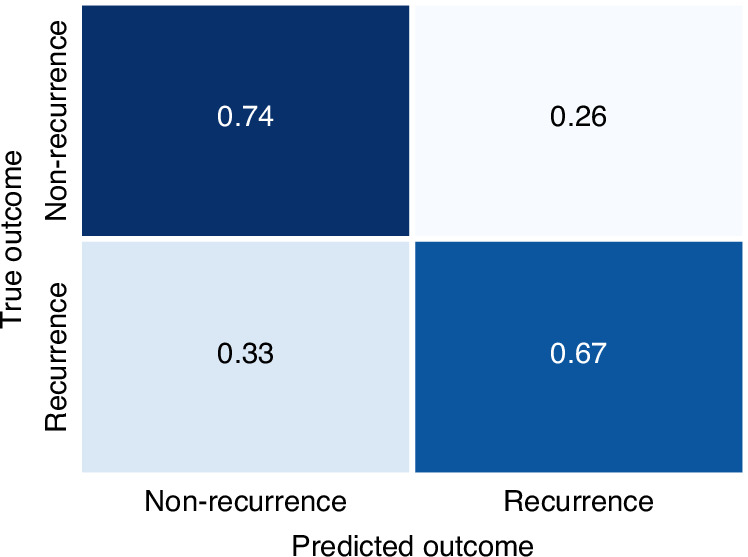 Deep learning-based interpretable prediction of recurrence of diffuse large B-cell lymphoma.