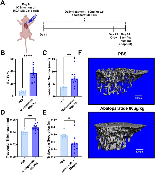 Abaloparatide increases bone mass without affecting growth of bone-disseminated cancer cells.