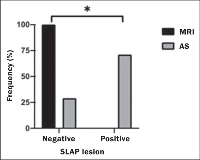 Analysis of the incidence of false-negative results for SLAP lesions on magnetic resonance imaging.