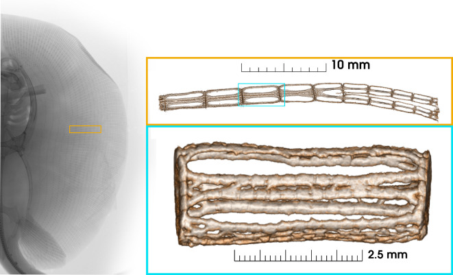 Generative design as a tool to analyse the uncertain loading regimes of intricate skeletal structures.