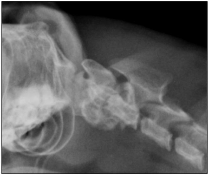 Ventral fixation and dorsal decompression of a complex occipitoatlantoaxial malformation using a custom-made plate in a cat.