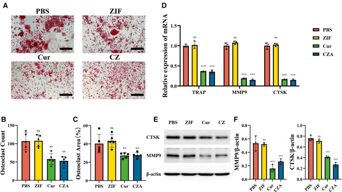 An acid-responsive bone-targeting nanoplatform loaded with curcumin balances osteogenic and osteoclastic functions.