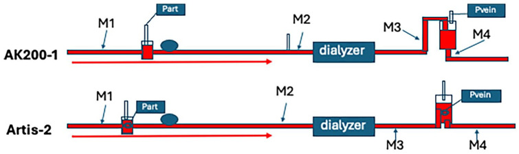 Contamination of microbubbles of air may occur at all investigated measurement points during hemodialysis.