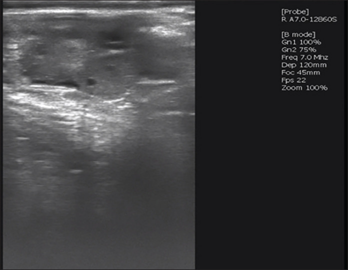 A comparative study of intramuscular versus epidural administration of follicle-stimulating hormone for embryo production in Wagyu Cattle.
