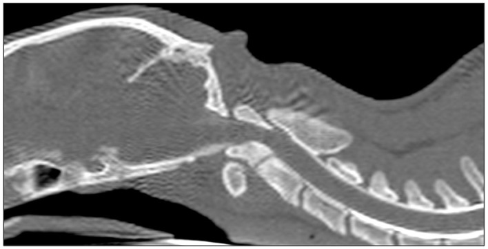 Ventral fixation and dorsal decompression of a complex occipitoatlantoaxial malformation using a custom-made plate in a cat.