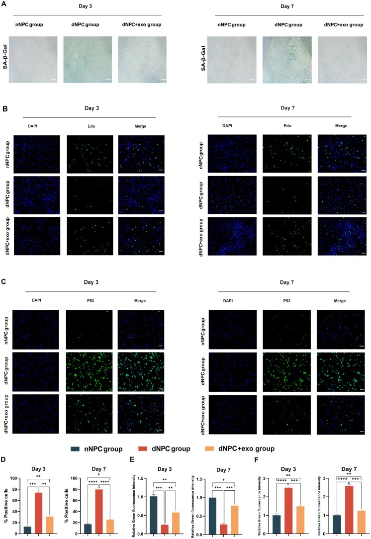 Injectable hydrogel loaded with exosomes from hypoxic umbilical cord-derived mesenchymal stem cells alleviates intervertebral disc degeneration by reversing nucleus pulposus cell senescence.