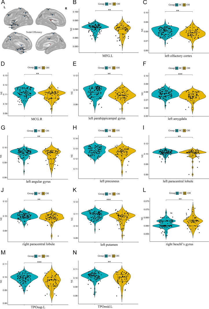Alterations of brain white matter network topological properties in overt hypothyroidism.
