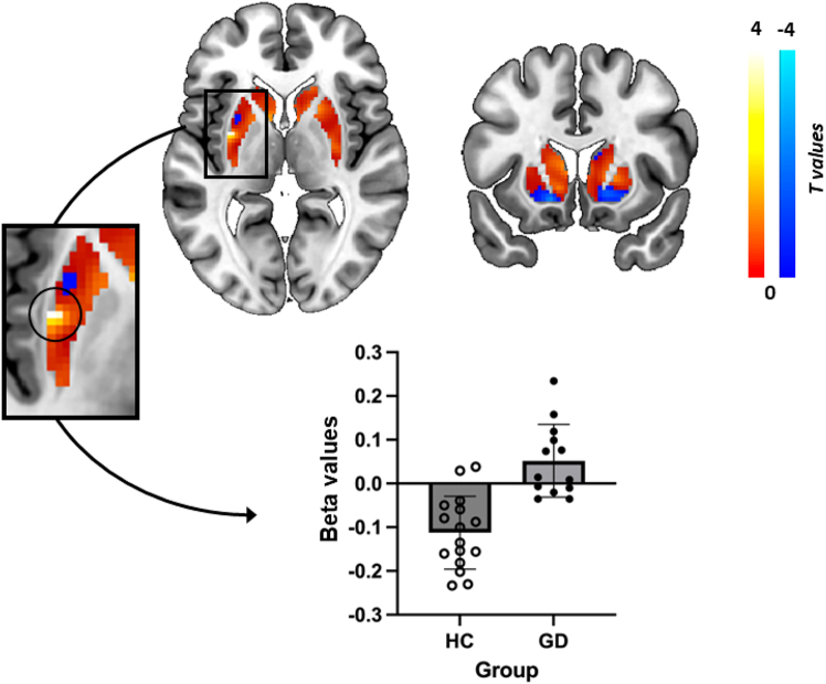 Striatal cue-reactivity and neurotransmitter function in gambling disorder.