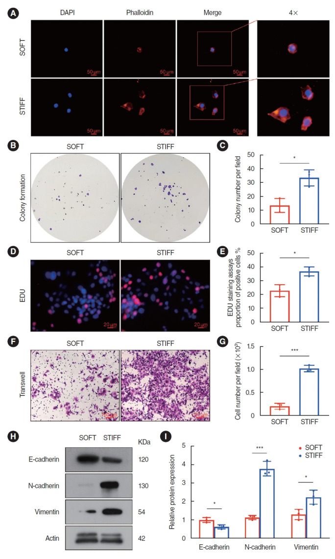EFNA2 Mediates Stiffness-Regulated Hypopharyngeal Cancer Progression.