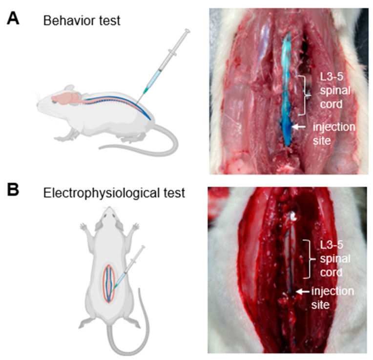 Development of a Novel Method of Spinal Electrophysiological Assessment via Intrathecal Administration at Analgesic Doses.