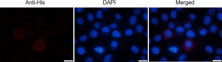 Functional analysis of <i>BmTsp.C</i> in modulating infection of BmNPV through apoptosis pathways in domestic silkworm (<i>Bombyx mori</i>).