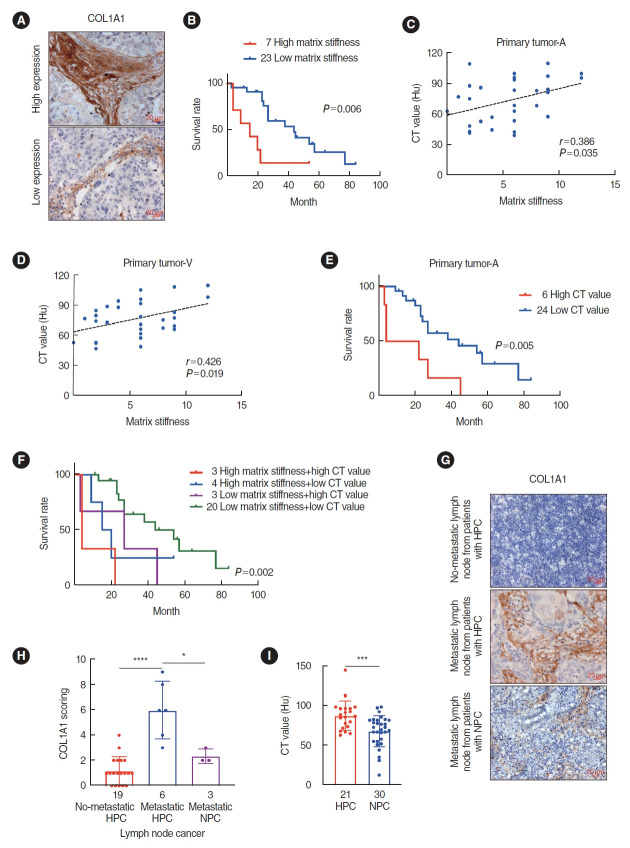 EFNA2 Mediates Stiffness-Regulated Hypopharyngeal Cancer Progression.