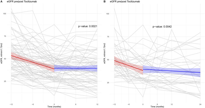Tocilizumab-Based Treatment of Microvascular Inflammation in Kidney Transplant Recipients: A Retrospective Study.