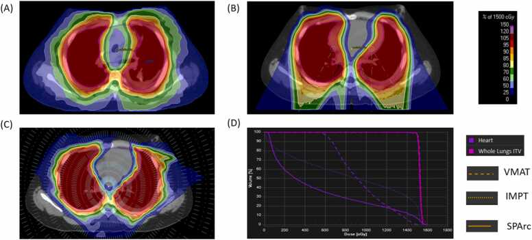 Feasibility of Utilizing Spot-Scanning Proton Arc (SPArc) for Whole-Lung Irradiation: A Case Report.