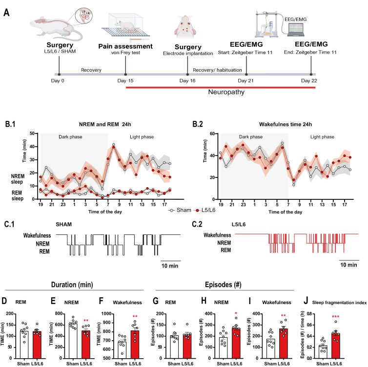 Neuropathic pain impairs sleep architecture, non-rapid eye movement sleep, and reticular thalamic neuronal activity.