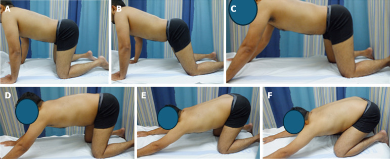 Promising technique for managing nonspecific chronic low back pain using multi angular isometric lumbar exercise.