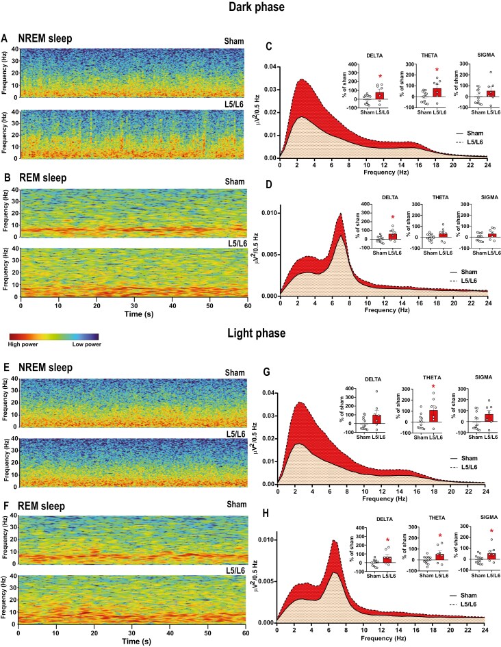Neuropathic pain impairs sleep architecture, non-rapid eye movement sleep, and reticular thalamic neuronal activity.