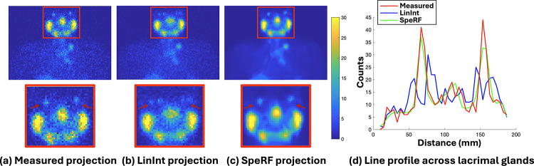 Shorter SPECT scans using self-supervised coordinate learning to synthesize skipped projection views.