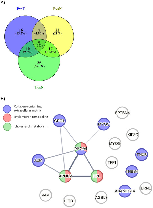 Proteome of Renal Tubuli and Serum Differentiate Pre-Existing Type 2 Diabetes and Post-Transplant Diabetes in Kidney Transplant Recipients.