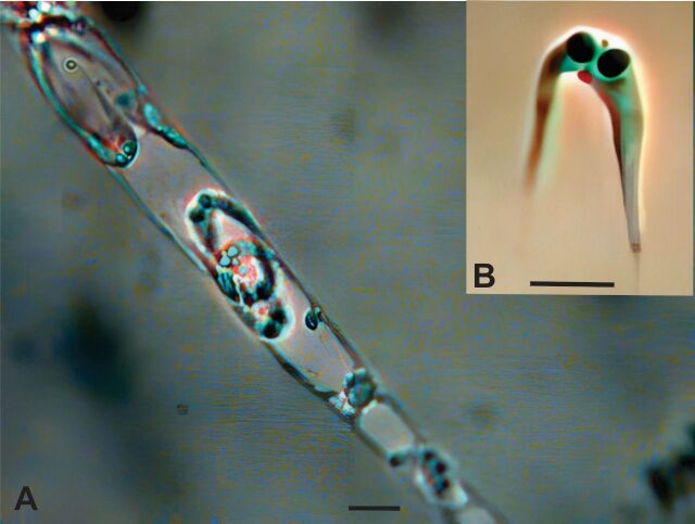 Morphology and molecular characterization of Ceratomyxa sp. (Cnidaria, Myxosporea, Ceratomyxidae), infecting the gallbladder of Curimata cyprinoides (Characiformes: Curimatidae) in the lower Araguaia River, Brazil.