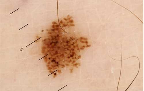Lack of communication between dermatologists and histopathologists in real-life settings: a survey of the Italian Association of Hospital Dermatologists (ADOI).