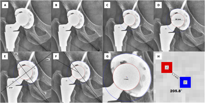 In Young Patients Undergoing Total Hip Arthroplasty, Is There a Correlation Between Activity Level and Wear of Highly Cross-Linked Polyethylene?