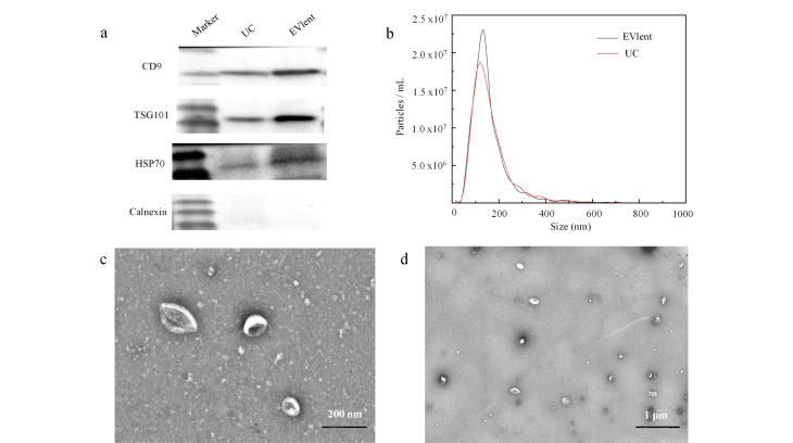 [Efficient capture and proteomics analysis of urinary extracellular vesicles by affinity purification].