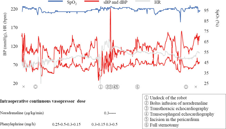Importance of anesthesiologists' non-technical skills in the management of a case of life-threatening cardiac tamponade during robot-assisted thoracic surgery.