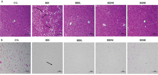 Fermented ginseng powder enriched with rare ginsenosides ameliorates high-fat diet-induced obesity by modulating adipogenesis and inflammation.