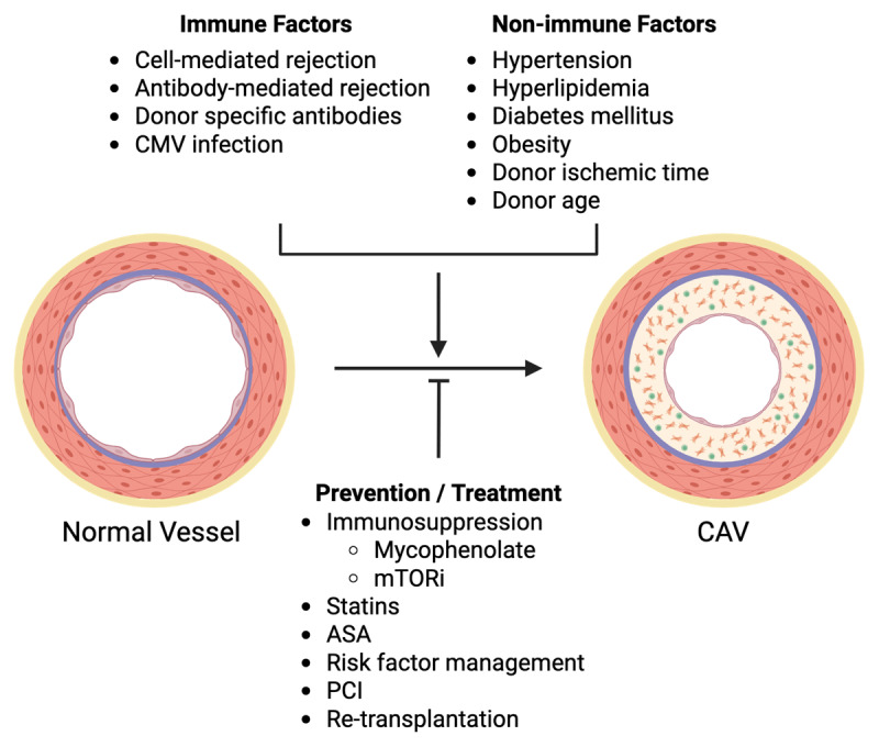 Cardiac Allograft Vasculopathy: A Focus on Advances in Diagnosis and Management.