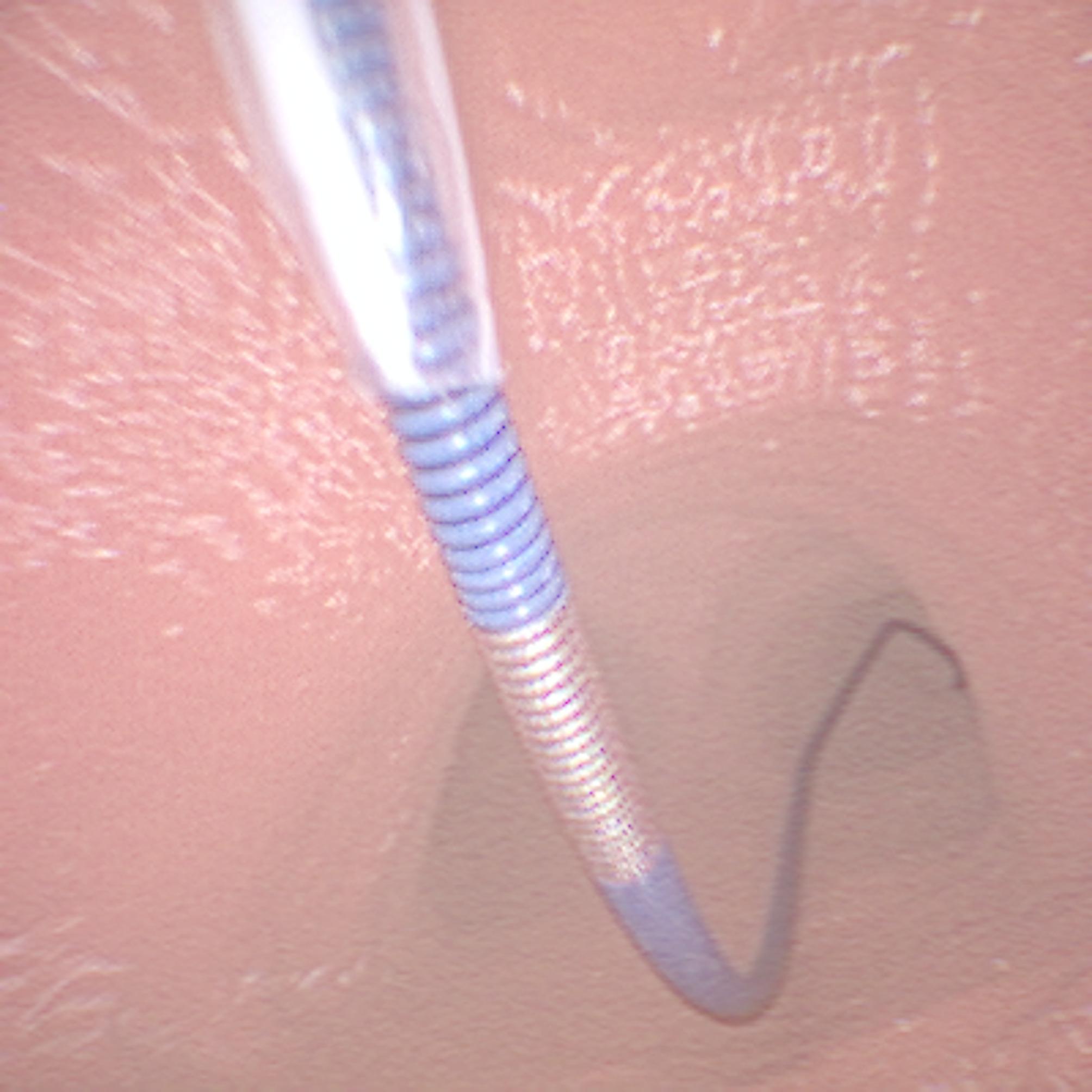 Unperceived bronchial bleeding complications during percutaneous dilatational tracheotomy: a case report and 3D simulation.