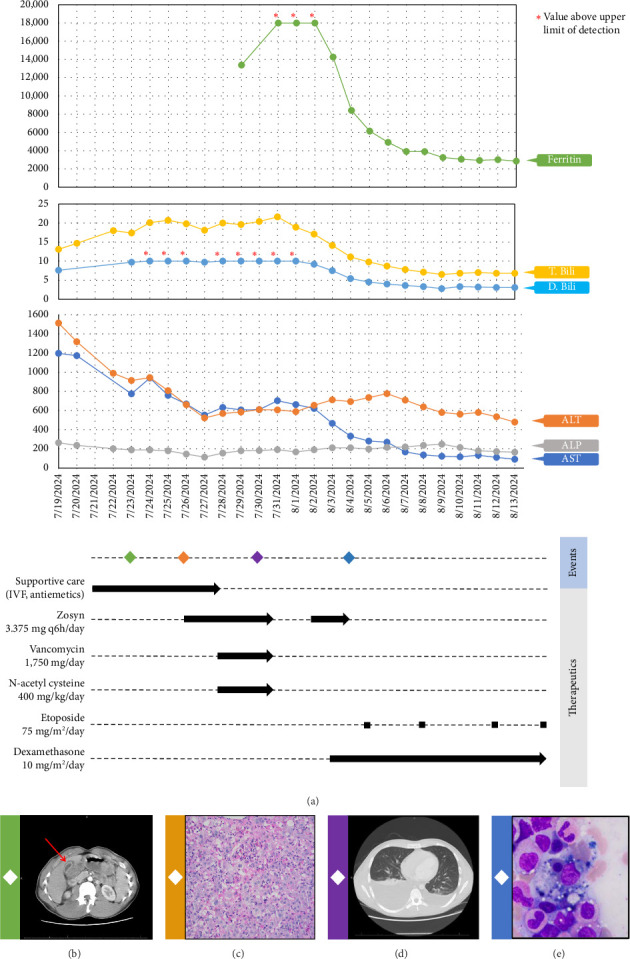 Hemophagocytic Lymphohistiocytosis Complicating a Case of Drug-Induced Liver Injury Precipitated by Cephalexin: A Rare Consequence of Commonly Prescribed Medications.
