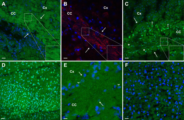 Serum immunoreactivity to neurofilament-medium shows high sensitivity and specificity in patients with Behçet disease.