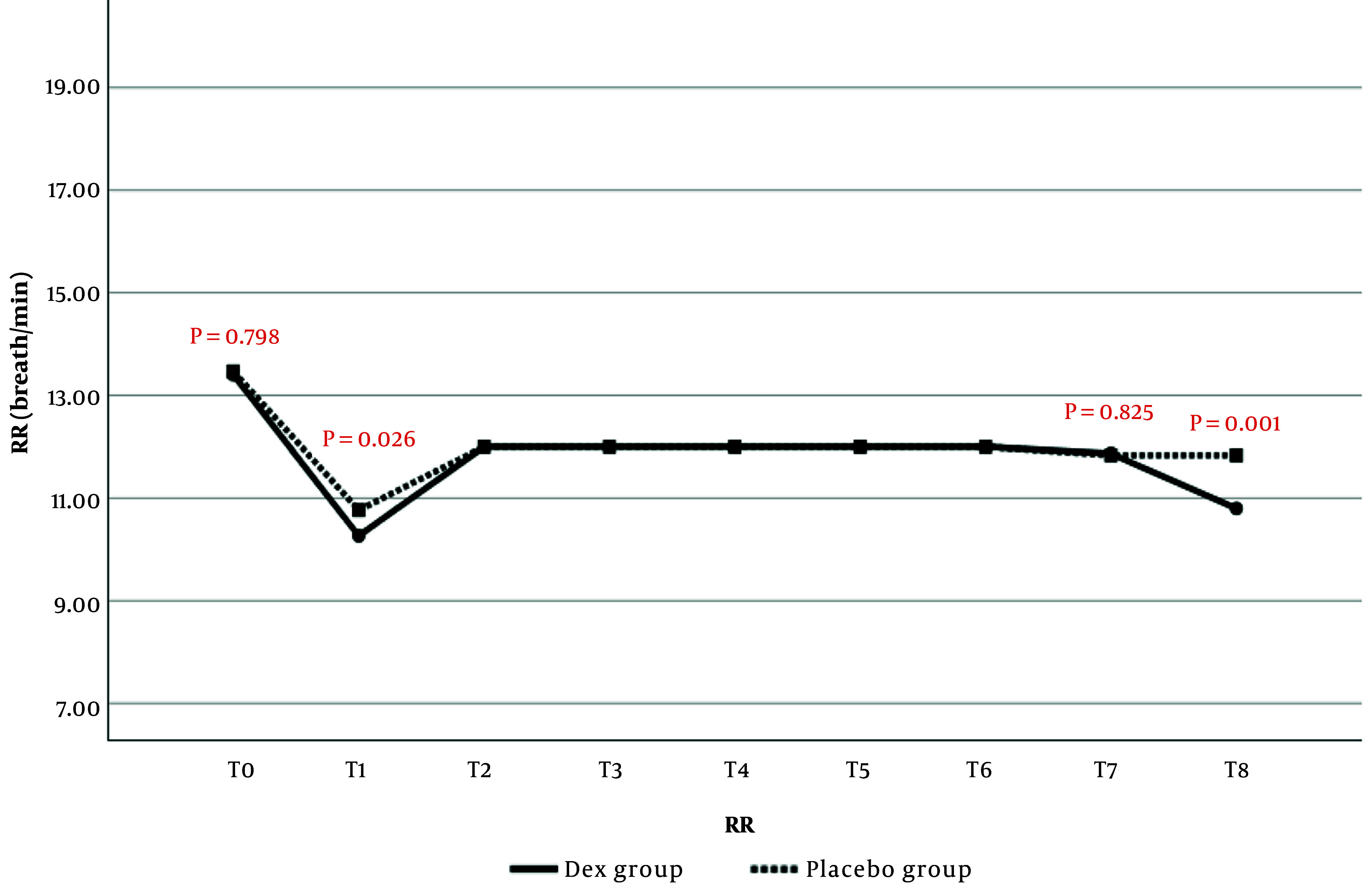The Effect of Intravenous Dexmedetomidine During Surgery in the Prevention of Shivering After General Anesthesia in Patients Undergoing Spinal Surgery: A Randomized Clinical Trial.