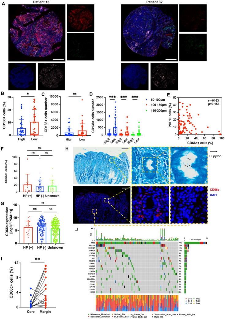 Identification of CD66c as a potential target in gastroesophageal junction cancer for antibody-drug conjugate development.