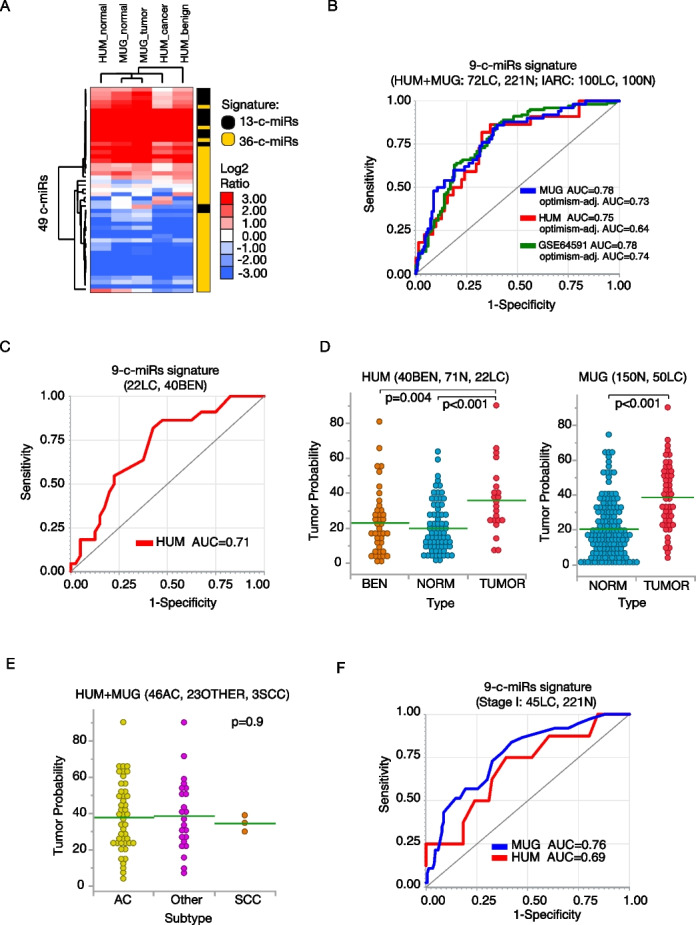 A plasma 9-microRNA signature for lung cancer early detection: a multicenter analysis.