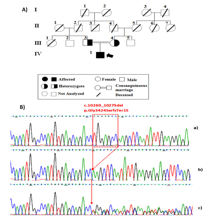 Comprehensive analysis of a novel LYST mutation in a Tunisian patient with Chediak-Higashi syndrome.