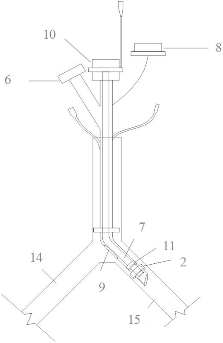 A Recently Patented Sleeve-Type Endotracheal Tube: Innovative Design and Clinical Prospects for Improving One-Lung Ventilation.