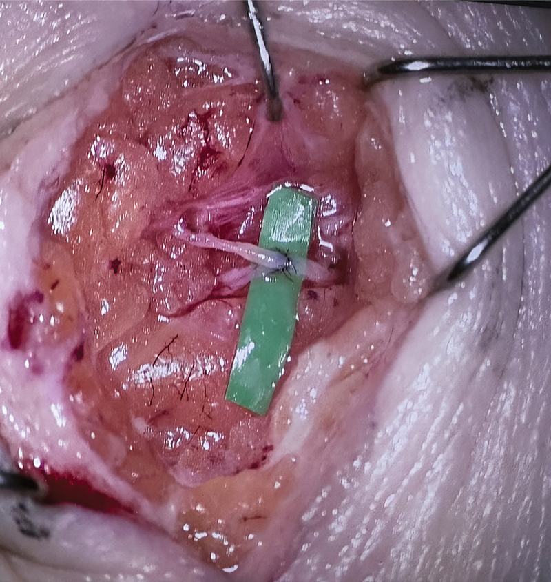 Reflections on the Asan Medical Center Plastic Surgery Visit: A Well-Organized Specialized Team and Excellent Leadership.