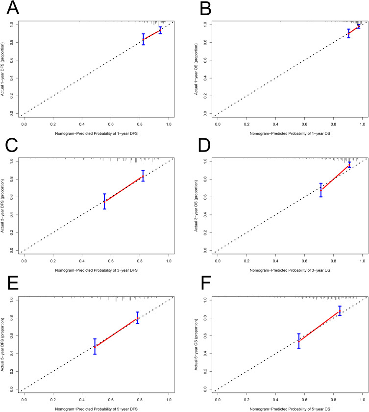Naples Prognostic Score (NPS) as a Novel Prognostic Score for Stage III Breast Cancer Patients: A Real-World Retrospective Study.