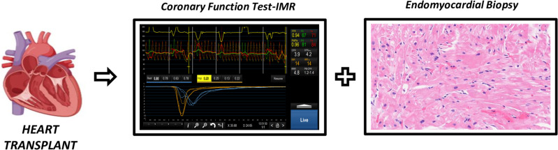 Index microvascular resistance (IMR) in heart transplant patients (IMR-HT study): Study protocol.