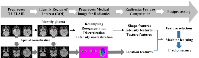 Morphometric and radiomics analysis toward the prediction of epilepsy associated with supratentorial low-grade glioma in children.