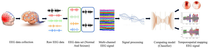 iSeizdiag: toward the framework development of epileptic seizure detection for healthcare.