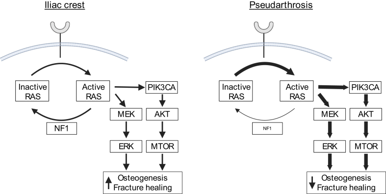 Molecular Basis of Fracture Pseudarthrosis Associated with Neurofibromatosis Type 1.