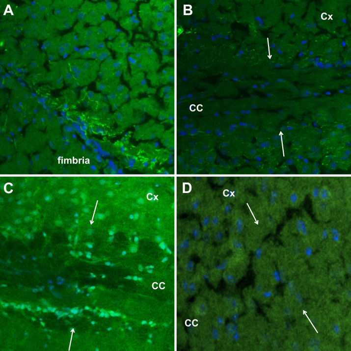 Serum immunoreactivity to neurofilament-medium shows high sensitivity and specificity in patients with Behçet disease.