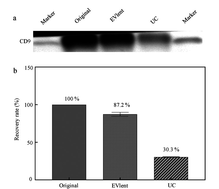 [Efficient capture and proteomics analysis of urinary extracellular vesicles by affinity purification].