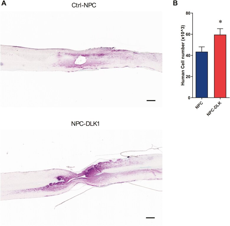 DLK1-expressing neural progenitor cells promote tissue repair and functional recovery after cervical spinal cord injury.