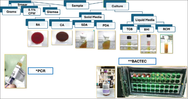 Diagnostic microbiology for intraocular infections: A comprehensive approach.